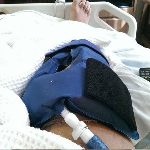 Post-Op Meniscus Tear